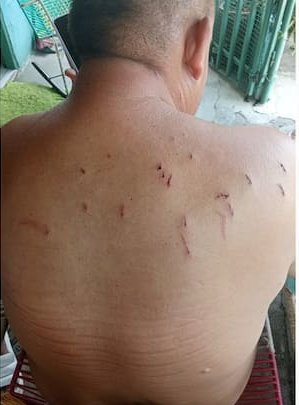 Taxista fue apuñalado 14 veces en medio de un hurto 1 Taxista fue apuñalado 14 veces en medio de un hurto Las autoridades lograron detener a uno de los tres sujetos que presuntamente estuvo involucrado en la agresión al taxista.
