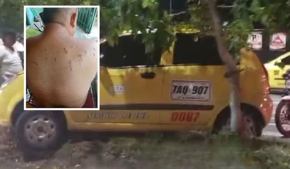 Taxista fue apuñalado 14 veces en medio de un hurto 1 Taxista fue apuñalado 14 veces en medio de un hurto Las autoridades lograron detener a uno de los tres sujetos que presuntamente estuvo involucrado en la agresión al taxista.