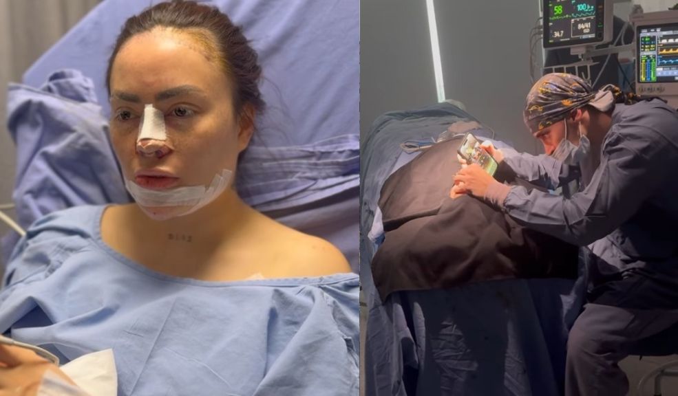 Tres nuevos "arreglitos" estéticos han puesto en riesgo la salud de Epa Colombia 4 Tres nuevos "arreglitos" estéticos han puesto en riesgo la salud de Epa Colombia Daneidy Barrera, conocida popularmente como Epa Colombia, atraviesa complicaciones de salud luego de someterse a tres cirugías estéticas. A través de sus redes sociales, Epa Colombia documentó todo el proceso, desde los preparativos antes de la cirugía hasta los difíciles momentos de recuperación.