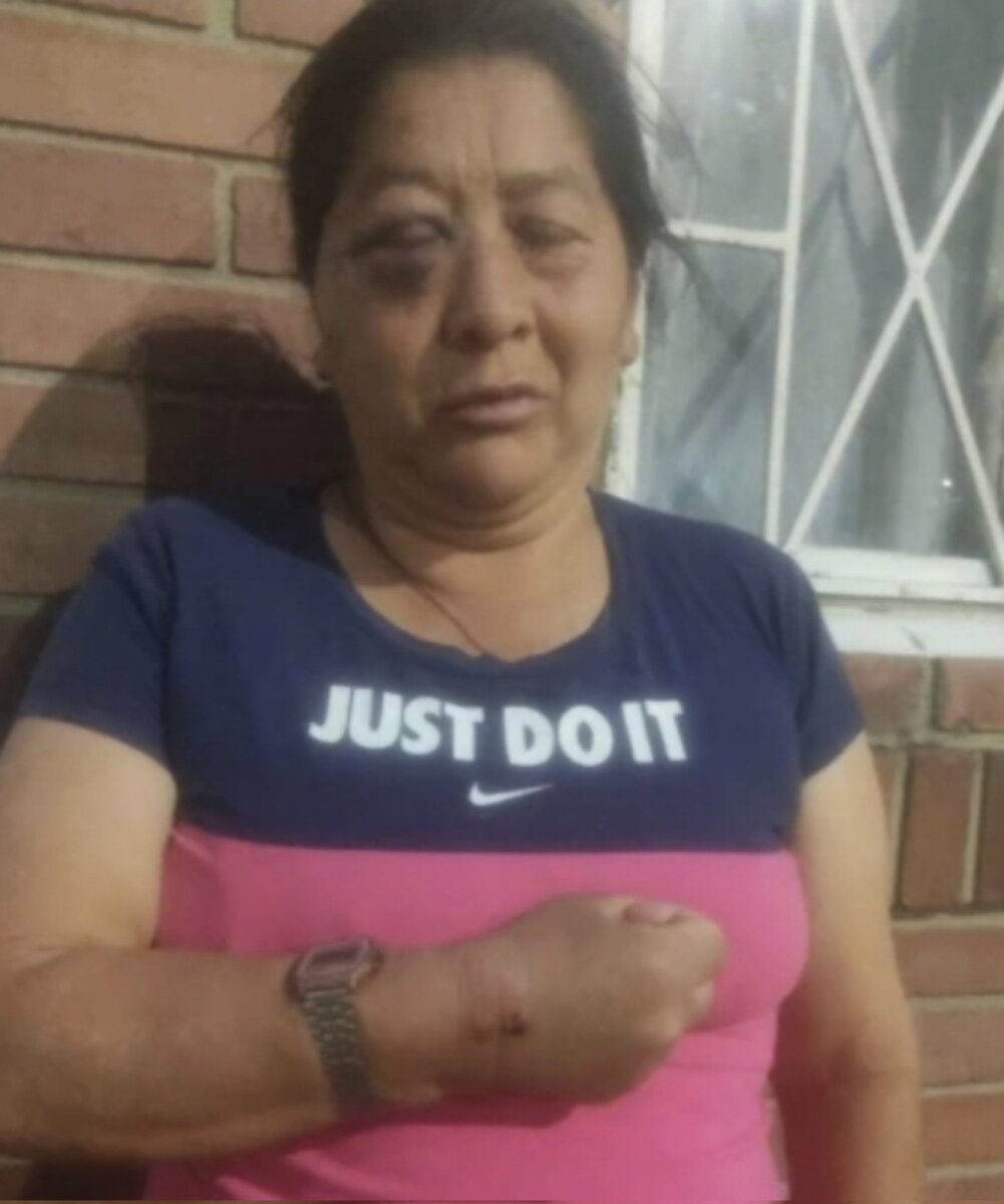 ¡Increíble! Ladrón atacó a mordiscos a una mujer para robarle el celular 1 ¡Increíble! Ladrón atacó a mordiscos a una mujer para robarle el celular Un delincuente atacó a mordiscos a una mujer para robarla. El hecho se presentó en la localidad de Kennedy.
