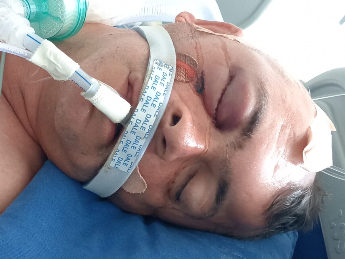 Fernando fue brutalmente agredido con un destornillador por su pareja sentimental en Usme La familia de Fernando denuncia que el hombre, de 53 años, fue brutalmente agredido por su pareja sentimental. Ahora se debate entre la vida y la muerte.