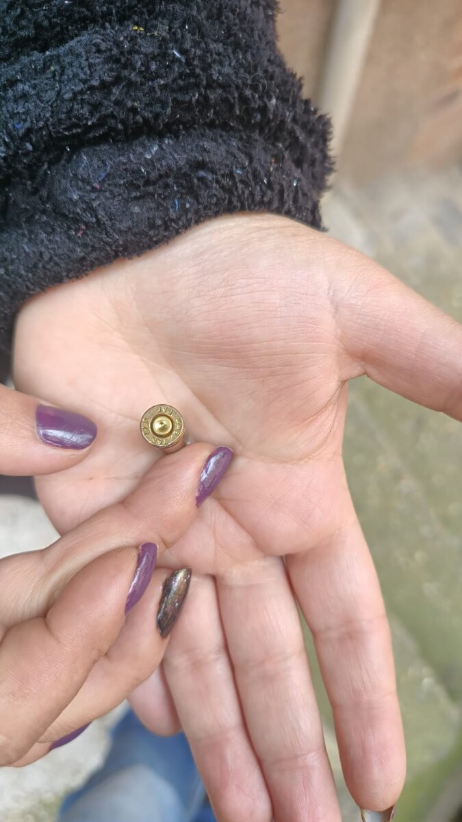 Menor fue agredido con un arma de fuego en medio de una riña en San Cristóbal Un menor de edad recibió un disparo tras una discusión entre su madre y una vecina en la localidad de San Cristóbal. Esto fue lo que sucedió.