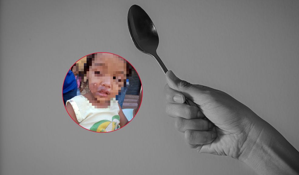Mujer le quemó la cara a su hija de 4 años con una cuchara caliente La mujer fue capturada y dejada a disposición de las autoridades.