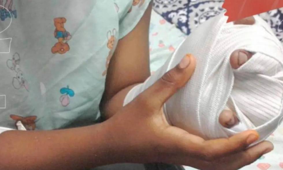 Ya son más de 60 reportes de quemados con pólvora en Bogotá La Secretaría de Salud de Bogotá reportó un total de 66 personas quemadas con pólvora desde la celebración de la Noche de Velitas, el pasado 7 de diciembre.