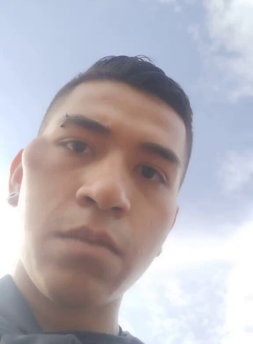 Joven agredido por una patrullera revela detalles del incidente Un joven identificado como Sebastián relató que una patrullera de la Policía lo golpeó con un bolillo durante un procedimiento en las calles de Bogotá, después de que este comenzara a grabar el registro con su celular.