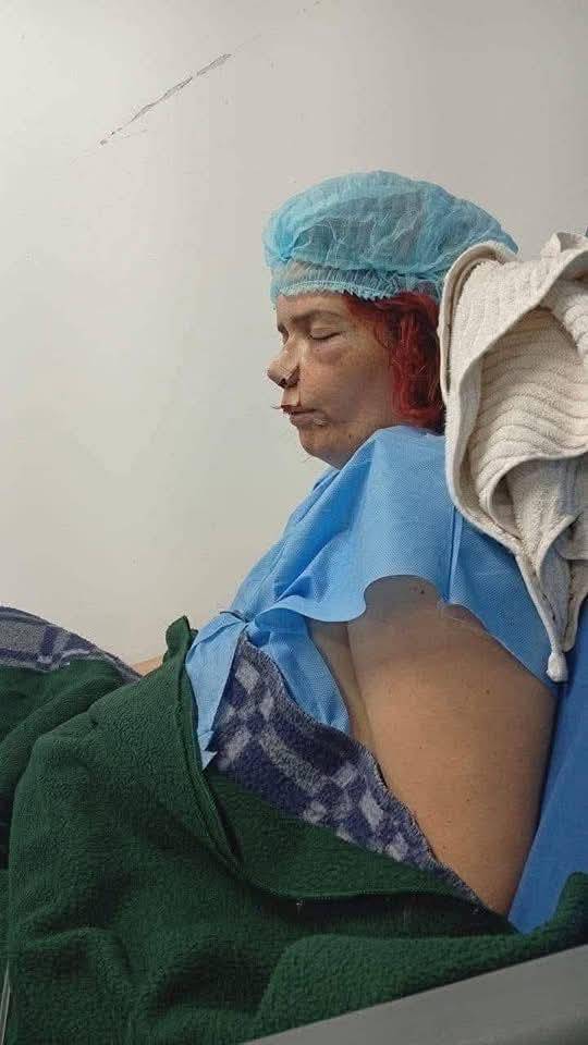 Sujeto atacó a mordiscos a su pareja en Kennedy; le destrozó el rostro 1 Sujeto atacó a mordiscos a su pareja en Kennedy; le destrozó el rostro El hombre habría atacado a su pareja en la madrugada del domingo 19 de enero en la localidad de Kennedy. Se presume que esta no sería la primera vez que el sujeto agrede a un mujer.