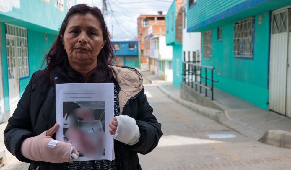 Vecino atacó con un machete a Giovanna en Ciudad Bolívar; por poco muere El agresor le dio 3 machetazos a Giovanna, uno en la cabeza y otro en las manos. Los hechos ocurrieron en Ciudad Bolívar, al sur de Bogotá.