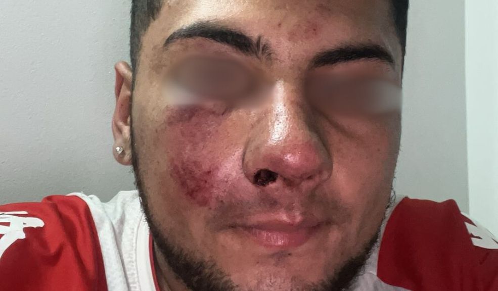 ¡Indignante! Lo golpearon por una gorra Tras el ataque, la víctima descubrió que los agresores subieron fotos a redes sociales, presumiendo lo que habían hecho y mostrando la gorra hurtada como trofeo.