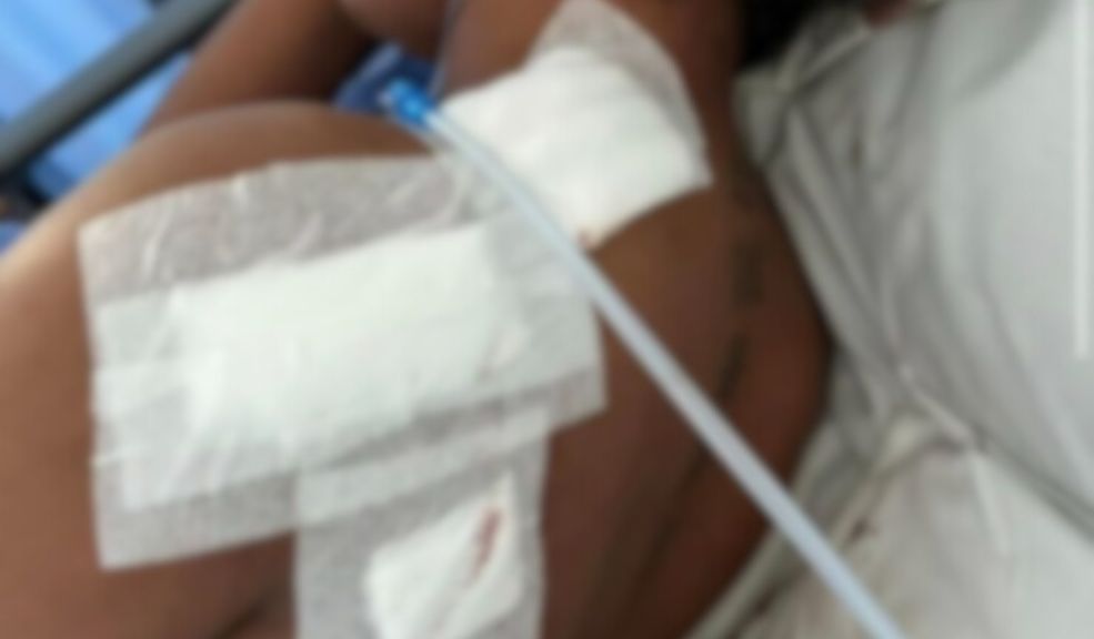Enfermera fue víctima de intento de feminicidio en Rafael Uribe; pide que se capture a su agresor 1 Enfermera fue víctima de intento de feminicidio en Rafael Uribe; pide que se capture a su agresor Una joven enfermera sobrevivió a un intento de feminicidio. Su expareja la apuñaló 6 veces. Este es su relato.