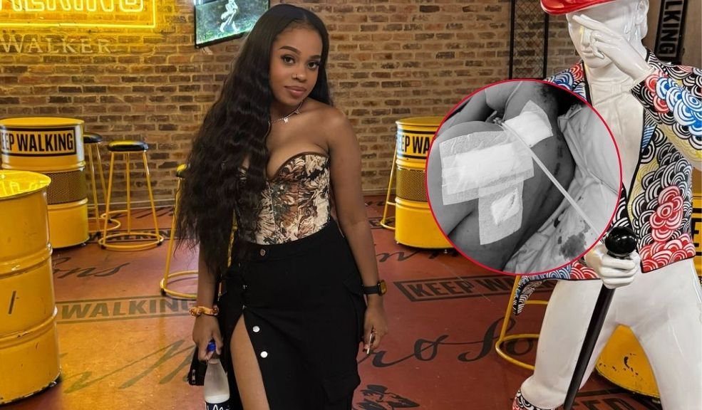 Enfermera fue víctima de intento de feminicidio en Rafael Uribe; pide que se capture a su agresor Una joven enfermera sobrevivió a un intento de feminicidio. Su expareja la apuñaló 6 veces. Este es su relato.