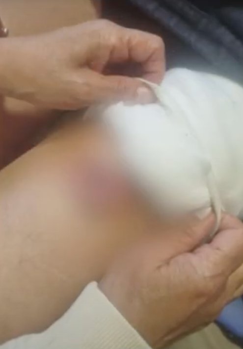 Profesora fue apuñalada en un bus del Sitp Una profesora fue herida con arma blanca durante un hurto en un bus del Sitp.