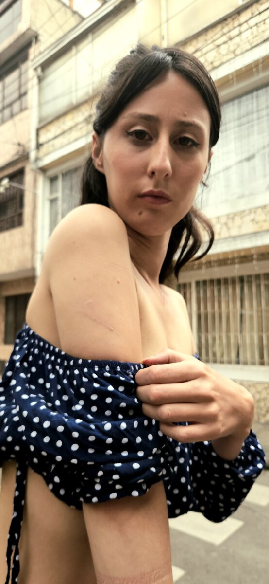 Domiciliaria denuncia violenta agresión con machete en Kennedy 1 Domiciliaria denuncia violenta agresión con machete en Kennedy María Alejandra Barrera Roa, de 25 años, madre de familia y trabajadora de domicilios por aplicación, denunció que fue víctima de una brutal agresión con un machete. A pesar de la gravedad del ataque, la justicia no ha avanzado en su caso y sus agresores siguen libres.
