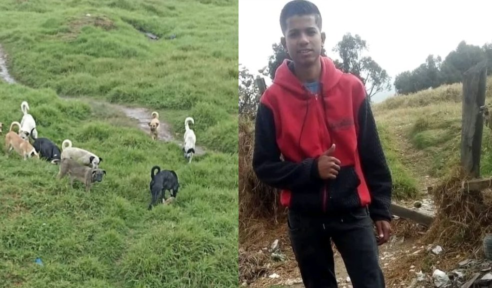 Joven de 19 años perdió sus brazos tras feroz ataque de perros callejeros