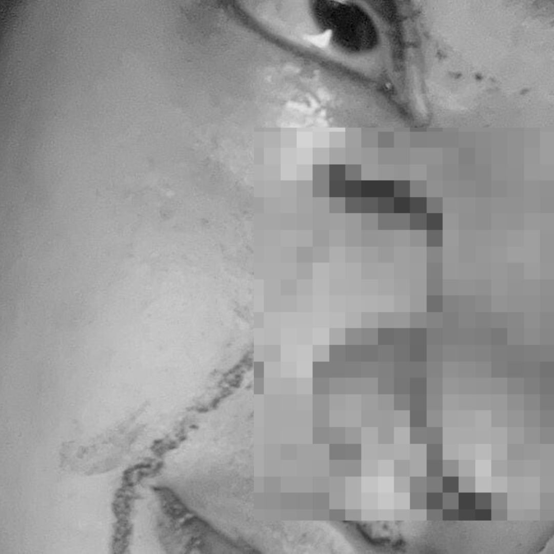 Ataque en Soacha Mujer apuñala a joven en el rostro y huye