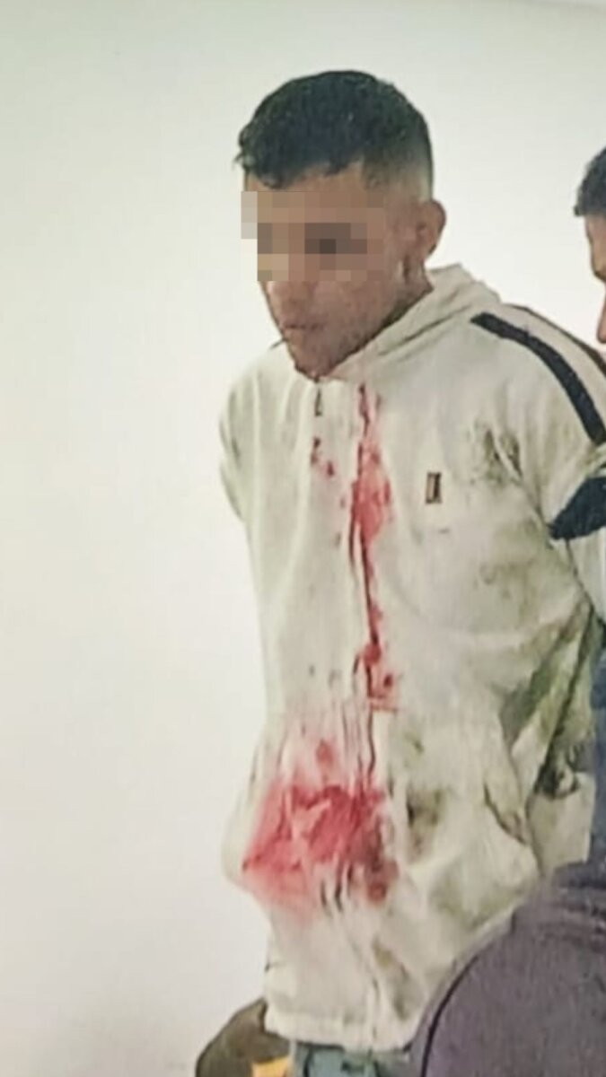 Capturan al agresor de Paula Alexandra Corredor por intento de feminicidio 1 Capturan al agresor de Paula Alexandra Corredor por intento de feminicidio