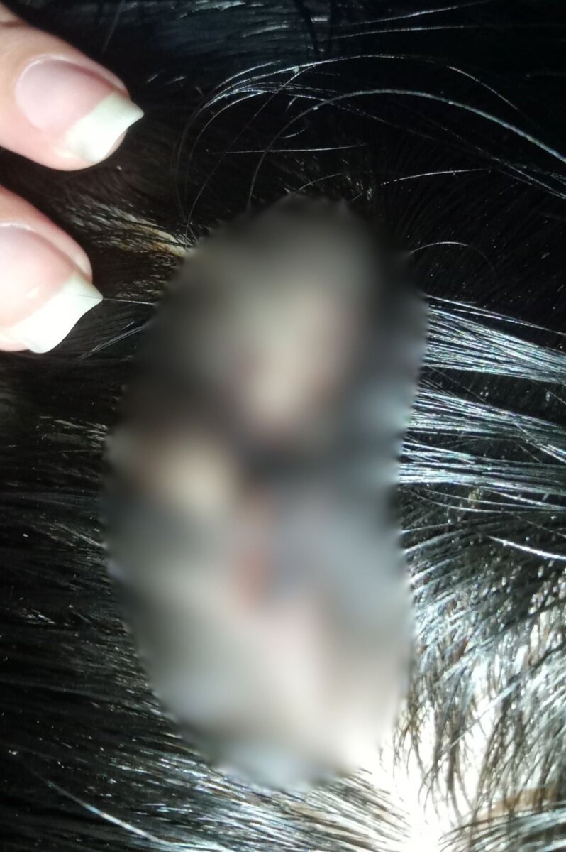 En Bosa: Le rompieron la cabeza por no poner una canción 3 En Bosa: Le rompieron la cabeza por no poner una canción Q’HUBO habló con Michel, quien relató el aterrador episodio cuando una clienta, le causó varias heridas en la cabeza porque no le pusieron la canción que había pedido.