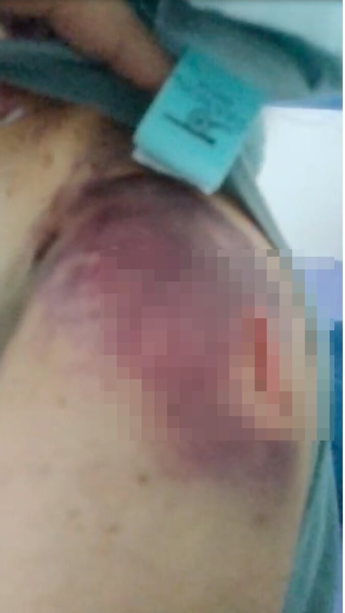 Ataque en Usme mujer fue apuñalada 10 veces por su expareja