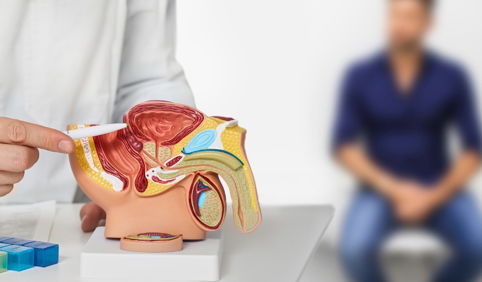 Cinco claves para prevenir el cáncer de próstata en Colombia A pesar de estas alarmantes cifras, persisten estigmas sociales que dificultan el diagnóstico temprano, siendo el temor al examen de tacto rectal una de las principales barreras.