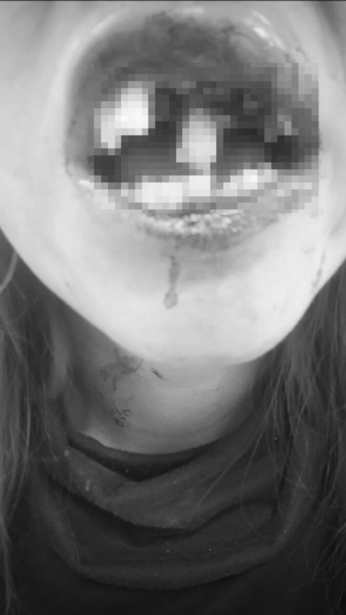 Denuncian brutal agresión de la Policía durante operativo en Kennedy
