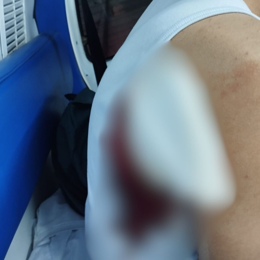 Denuncian que en Colegio de Usme estudiante apuñaló a otro 1 Denuncian que en Colegio de Usme estudiante apuñaló a otro Una madre denuncia que su hijo de 12 años fue apuñalado por otro menor dentro de un colegio en Usme. Aquí le contamos la denuncia.