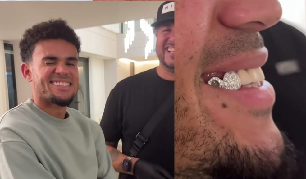 Lucho Díaz sonríe con brillo: así luce su nueva dentadura con diamantes