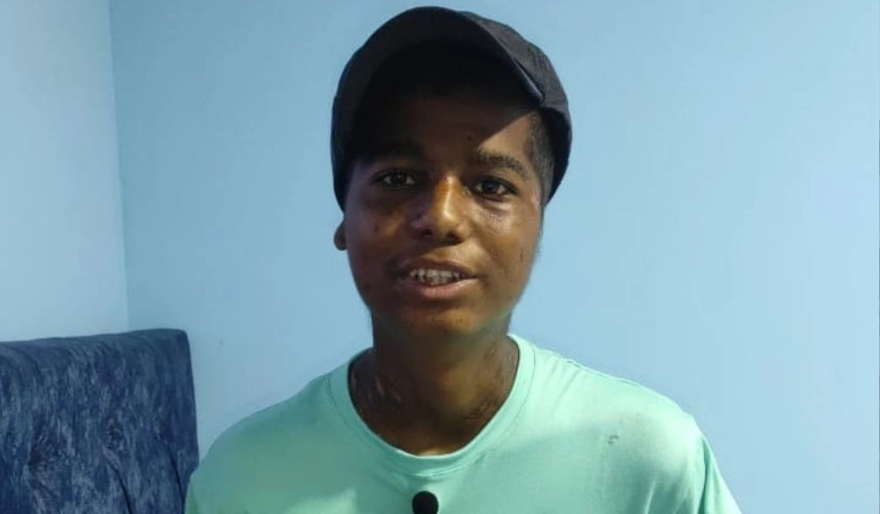 Greiber, víctima de un ataque de perros en Bosa: "Luché contra el diablo para que no me llevara" El joven venezolano perdió sus extremidades como consecuencia de las fuertes mordeduras de los perros que lo atacaron en Potreritos. Estuvo al borde de la muerte, pero hoy vive y nos cuenta su historia. Además, solicita ayuda.