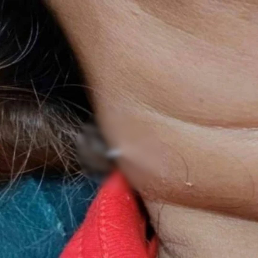 cuello