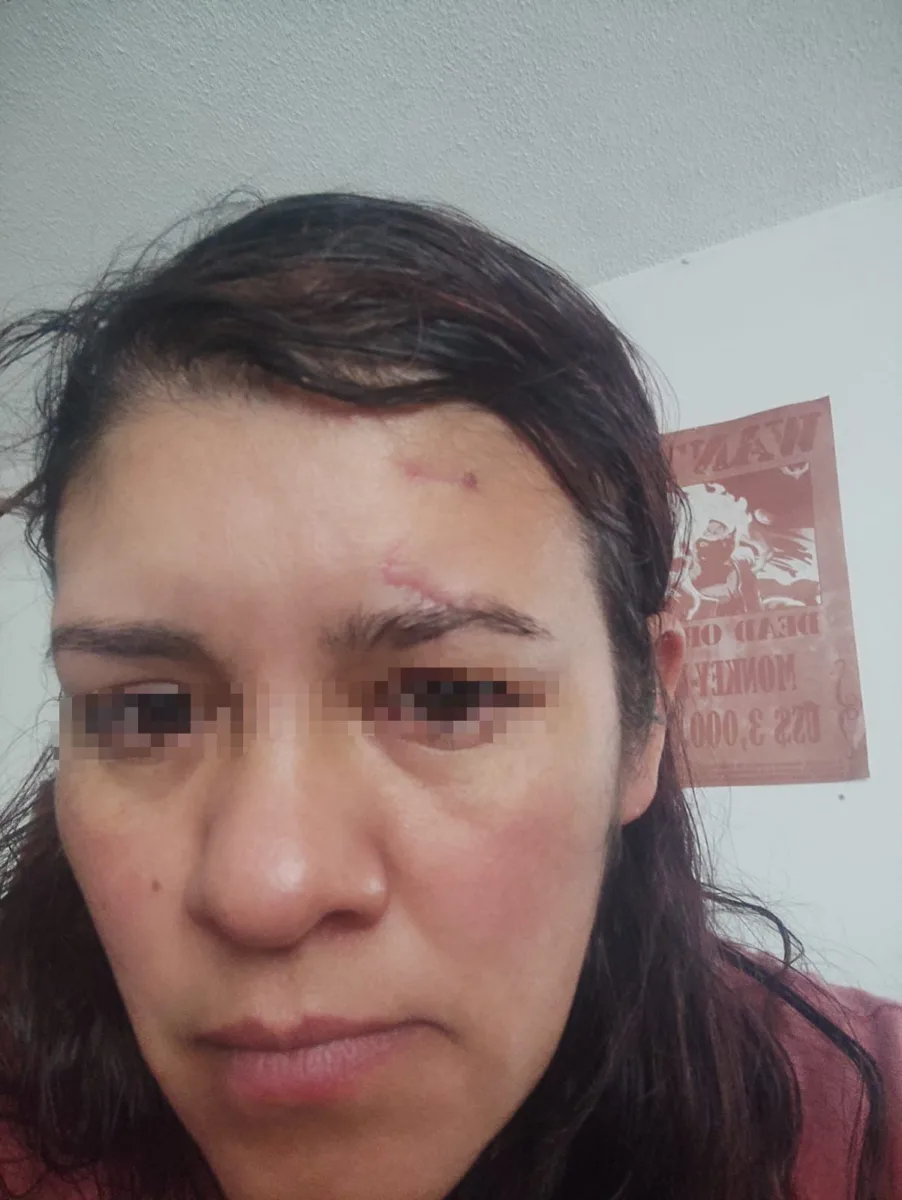 En calle de Teusaquillo, a una mujer le cortaron la cara con una botella Una guarda de seguridad de una estación de TransMilenio le relató a Q’HUBO cómo fue víctima de un agresor, quien, sin mediar palabra, la atacó con una botella, causándole graves heridas en su rostro. EL hecho ocurrió en una calle de Teusaquillo.