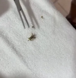 En video: extraen cangrejo vivo del oído de un niño 2 En video extraen cangrejo vivo del oído de un niño