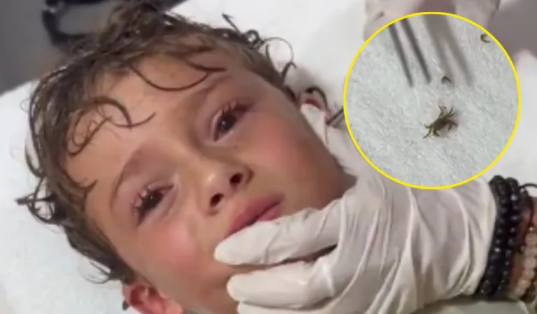 En video extraen cangrejo vivo del oído de un niño