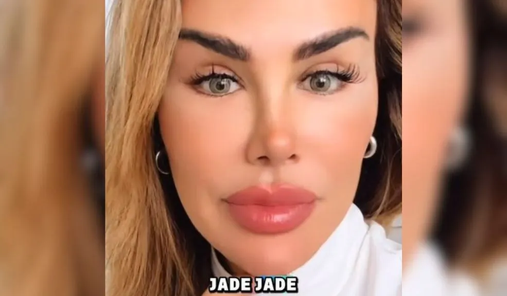 Ninel Conde, el 'Bombón Asesino', enciende las redes con su radical cambio en sus ojos Ninel Conde dejó a todos boquiabiertos: su nuevo color de ojos generó halagos, críticas y una ola de especulaciones sobre si se sometió a una cirugía estética.