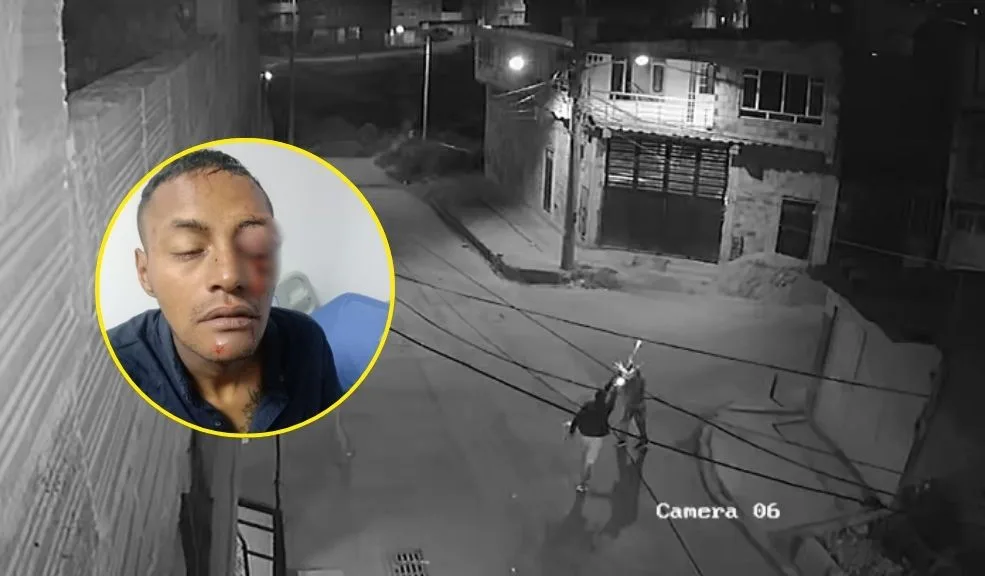 Usme: salvaje ataque a Estiven en Monte Blanco Einel Estiven Caicedo Alvarado, de 32 años, fue víctima de un brutal ataque a tiros cuando se encontraba muy cerca de su casa, en la calle 94 Sur con carrera 14B, en el barrio Monte Blanco de Usme.