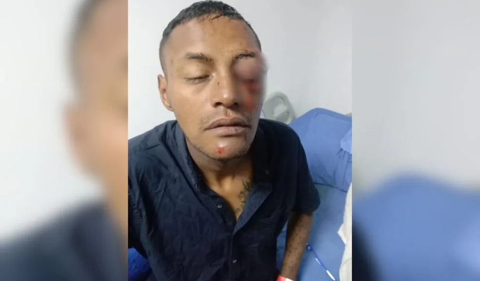 Usme: salvaje ataque a Estiven en Monte Blanco 1 Usme: salvaje ataque a Estiven en Monte Blanco Einel Estiven Caicedo Alvarado, de 32 años, fue víctima de un brutal ataque a tiros cuando se encontraba muy cerca de su casa, en la calle 94 Sur con carrera 14B, en el barrio Monte Blanco de Usme.