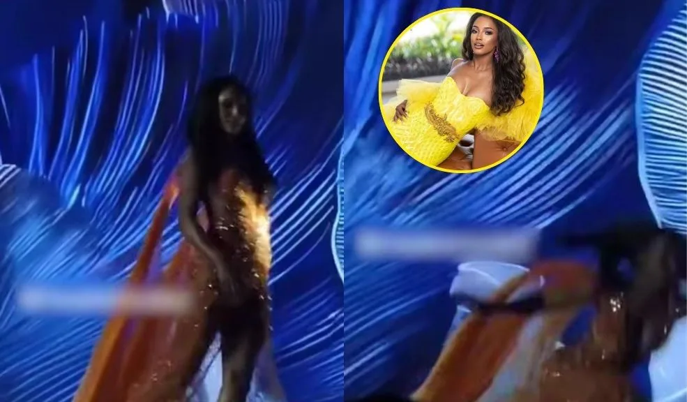 Miss Jamaica en UCI: su estado de salud es grave