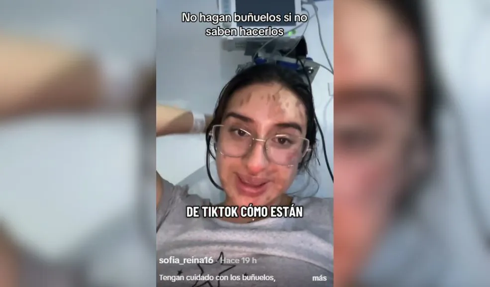 Adolescentes se quemaron la cara con 'buñuelos explosivos' En incidentes que han cobrado relevancia en plataformas digitales, dos jóvenes creadoras de contenido alertaron sobre los peligros de preparar buñuelos sin la técnica adecuada.