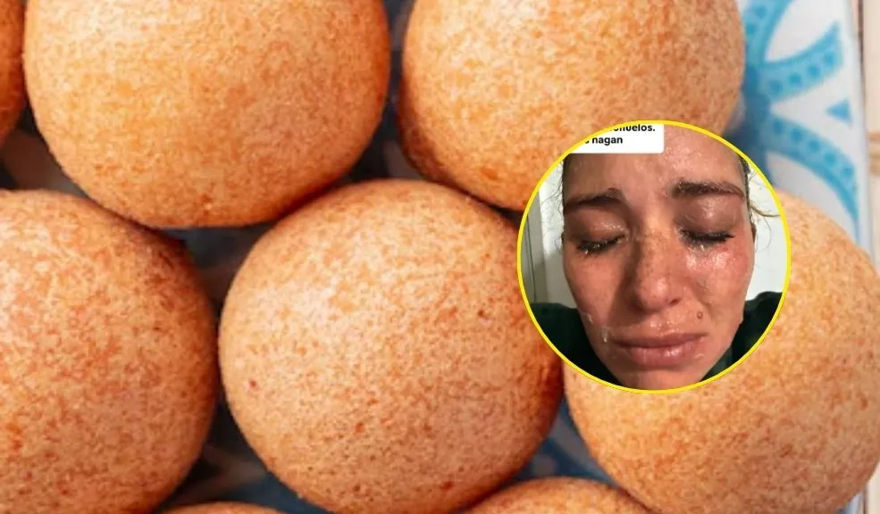 Adolescentes se quemaron la cara con 'buñuelos explosivos' En incidentes que han cobrado relevancia en plataformas digitales, dos jóvenes creadoras de contenido alertaron sobre los peligros de preparar buñuelos sin la técnica adecuada.
