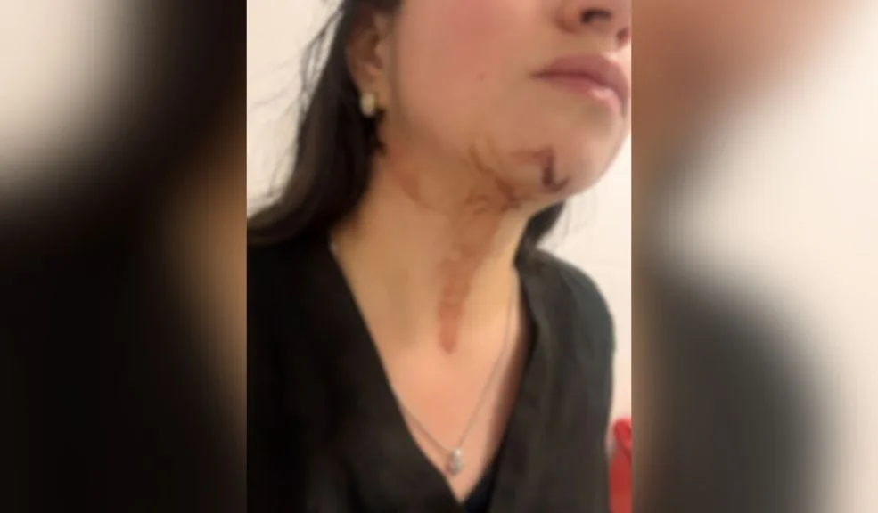 Bosa: depravado abordó y atacó a una mujer cuando se dirigía a casa El miedo camina en las calles de Bosa. Laura jamás pensó que el regreso a casa, tras una jornada laboral, se convertiría en una pesadilla que hoy la mantiene con temor y con secuelas psicológicas.