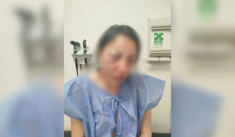 Ciudad Bolívar: Vicky fue abusada, golpeada y torturada 2 Ciudad Bolívar: Vicky fue abusada, golpeada y torturada Una mujer de 37 años fue víctima de un intento de feminicidio, en el que su expareja no solo la golpeó y la apuñaló, sino que además la torturó y abuso sexualmente en Cuidad Bolívar, así lo dio a conocer su hijo, Nicolás López, a Q’HUBO.