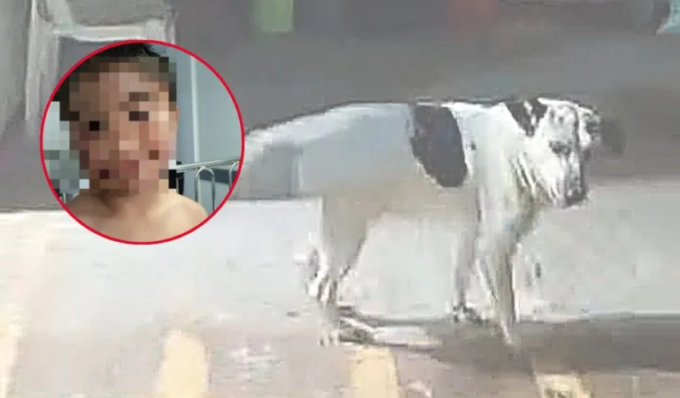 En Soacha niño de 8 años lucha por recuperarse tras ser atacado por un perro