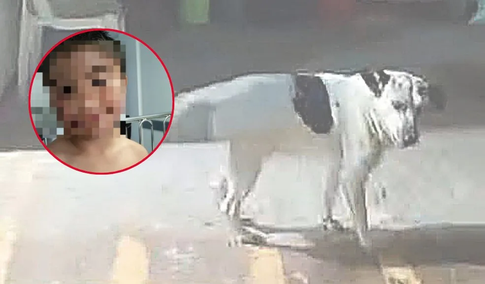 En Soacha niño de 8 años lucha por recuperarse tras ser atacado por un perro