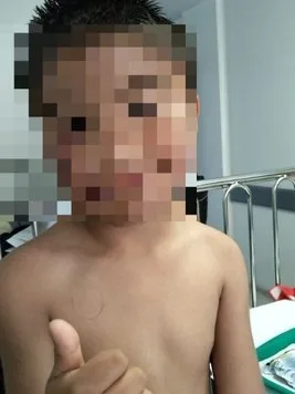 En Soacha: niño de 8 años lucha por recuperarse tras ser atacado por un perro 2 En Soacha niño de 8 años lucha por recuperarse tras ser atacado por un perro