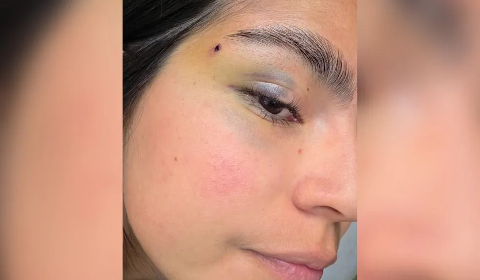 Usaquén: Paula fue agredida junto a su perrita por un vecino en el barrio Barrancas La denuncia de Paula Alejandra Sierra Rojas volvió a poner en el centro del debate la intolerancia y la violencia en espacios públicos. Según su relato, en el parque El Consuelo del Norte, ubicado en el barrio Barrancas (Usaquén), fue agredida por un vecino mientras se encontraba con su perrita.