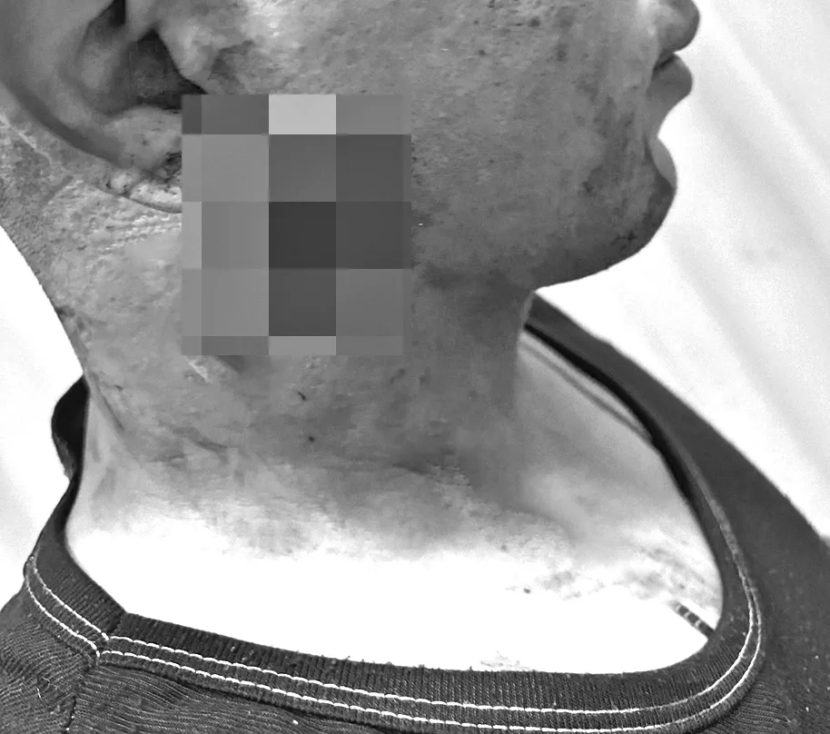 En Soacha: hombre denuncia haber sido atacado en la yugular por un desconocido Un padre de cuatro hijos vivió momentos de tensión tras ser víctima de un violento ataque por la espalda en las inmediaciones del barrio Lincoln, en Soacha.