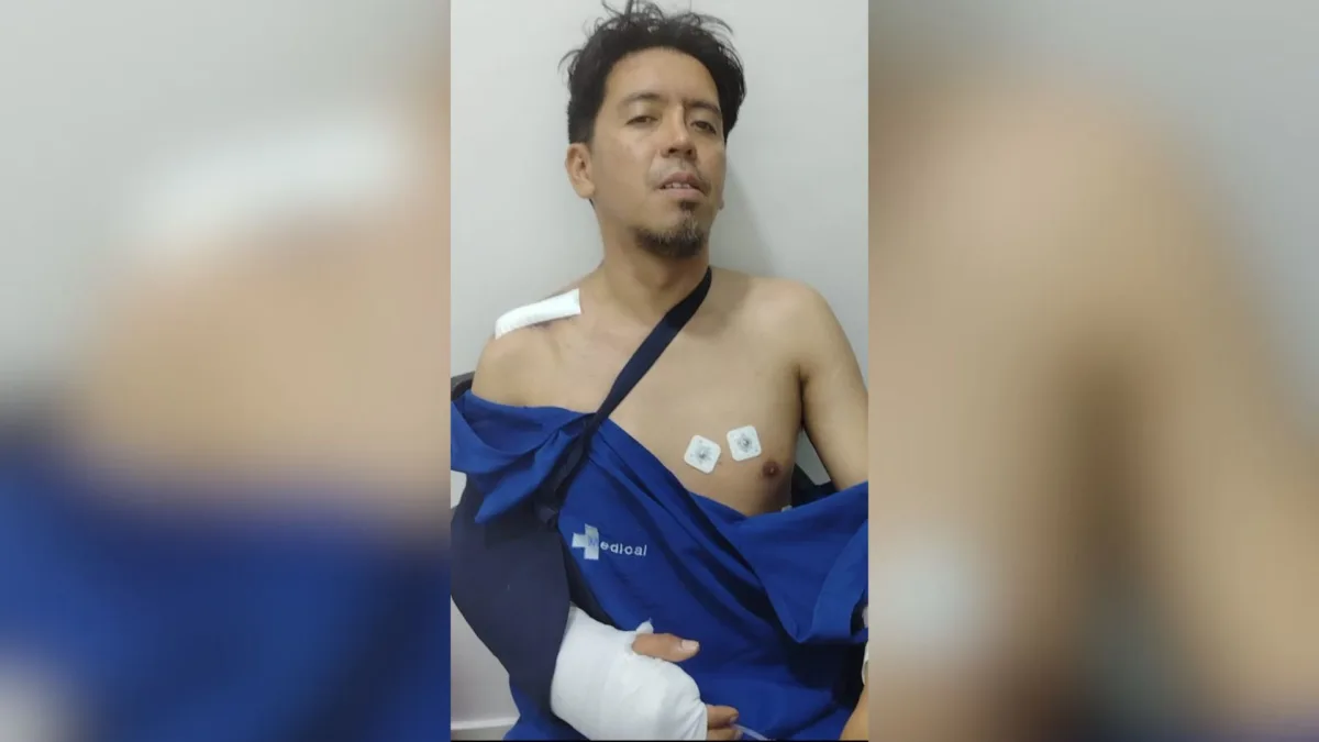 Engativá: Jhon vive un martirio por siniestro vial con un SITP Jhon Jairo Castro, de 39 años, se ganaba la vida como domiciliario en moto ante la falta de un empleo formal. Hoy enfrenta una incapacidad inicial de 30 días tras resultar gravemente herido en un siniestro vial.