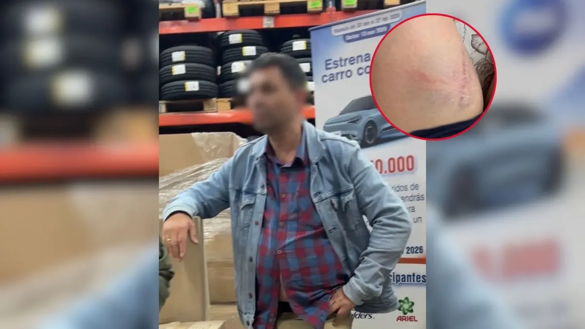 Joven denuncia agresión en reconocido almacén de cadena y presunta revictimización 4 Joven denuncia agresión en reconocido almacén de cadena y presunta revictimización Una joven acudió en compañía de su madre y su hermano de 10 años a realizar una compra en un reconocido almacén de cadena, sin imaginar que terminaría saliendo seriamente golpeada, vulnerada y, según denuncia, revictimizada por parte del almacén y de las autoridades de Policía que atendieron el caso.