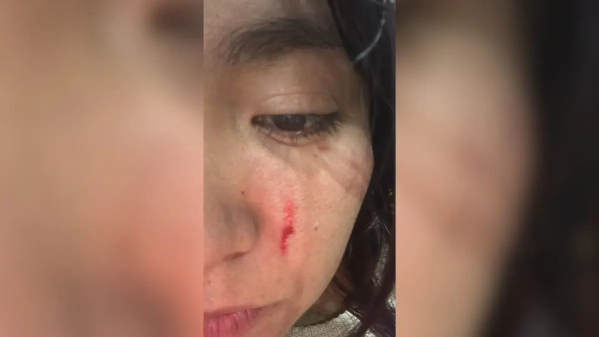 Joven denuncia agresión en reconocido almacén de cadena y presunta revictimización 2 Joven denuncia agresión en reconocido almacén de cadena y presunta revictimización Una joven acudió en compañía de su madre y su hermano de 10 años a realizar una compra en un reconocido almacén de cadena, sin imaginar que terminaría saliendo seriamente golpeada, vulnerada y, según denuncia, revictimizada por parte del almacén y de las autoridades de Policía que atendieron el caso.