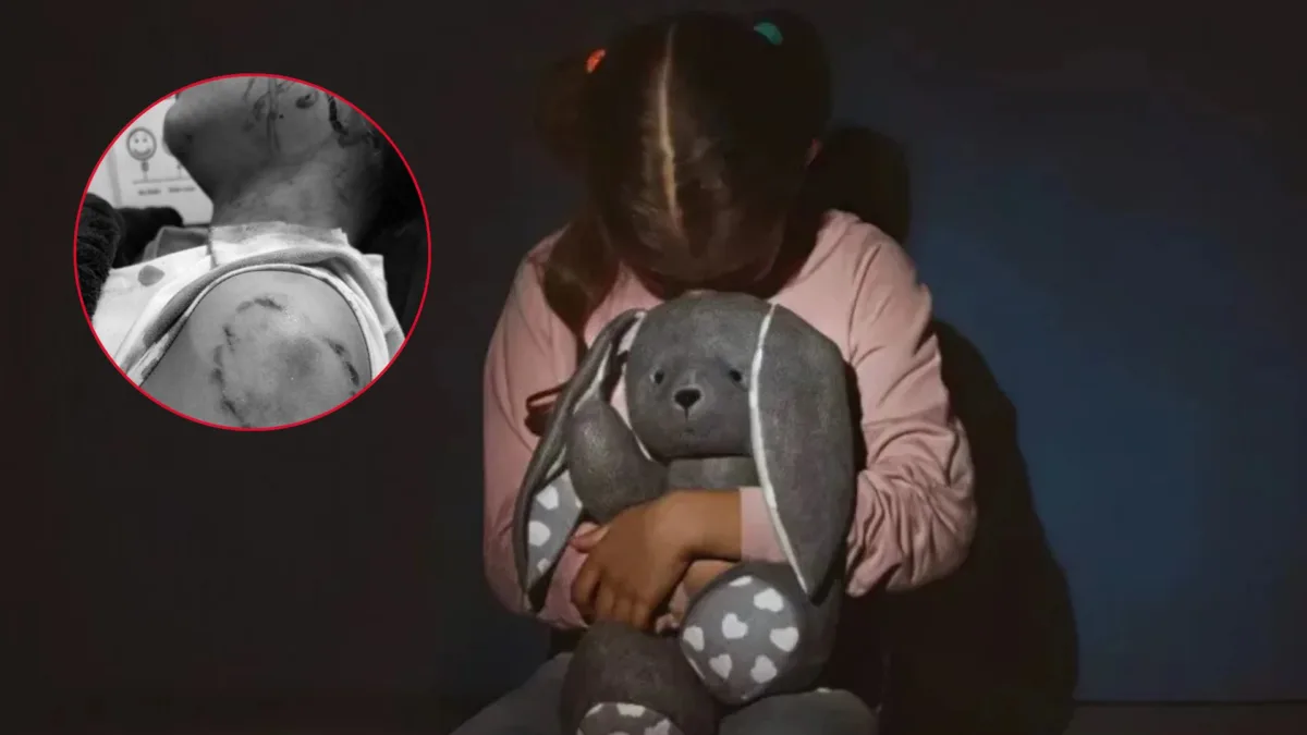 Menor fue apuñalada en un ojo por un desconocido que quedó en libertad El pasado domingo 15 de febrero, en una estación de servicio ubicada en la calle 170 con avenida Suba, un desconocido abordó violentamente un vehículo particular, tomando como rehén a una niña de 11 años.