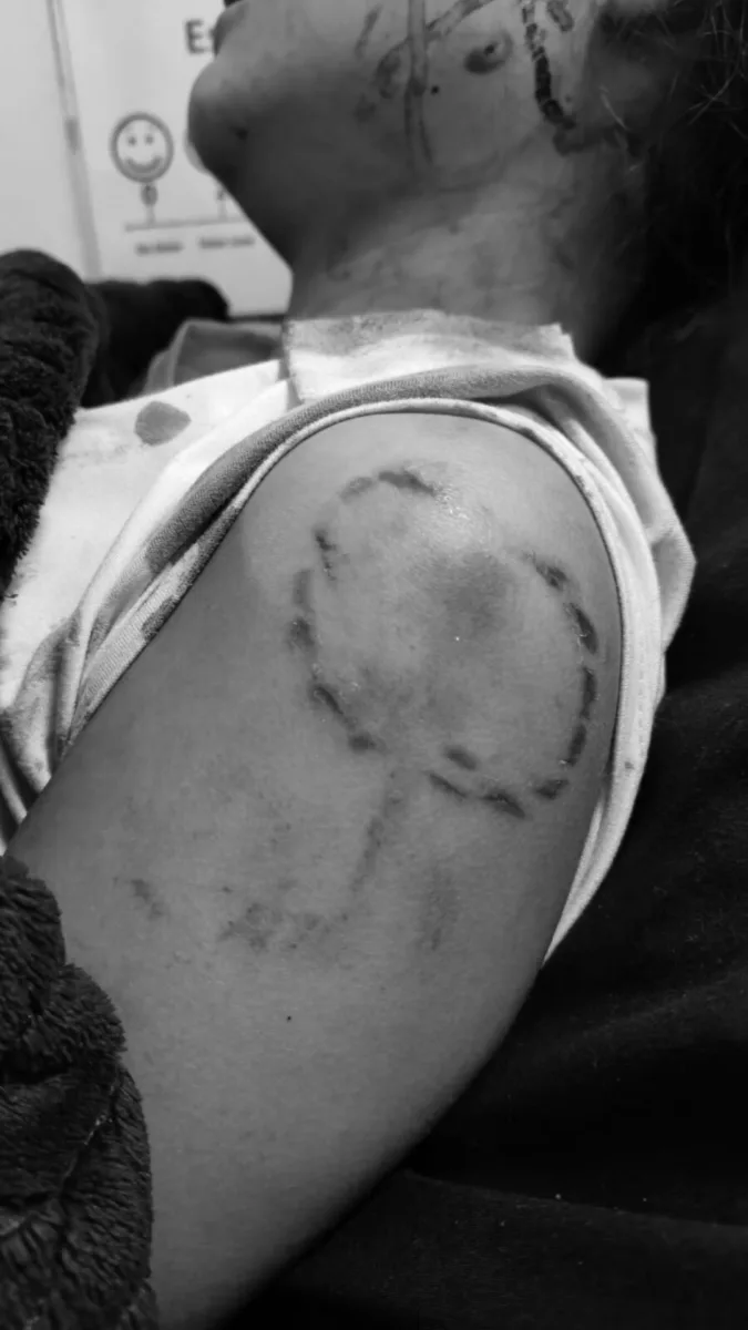 Menor fue apuñalada en un ojo por un desconocido que quedó en libertad 1 Menor fue apuñalada en un ojo por un desconocido que quedó en libertad El pasado domingo 15 de febrero, en una estación de servicio ubicada en la calle 170 con avenida Suba, un desconocido abordó violentamente un vehículo particular, tomando como rehén a una niña de 11 años.