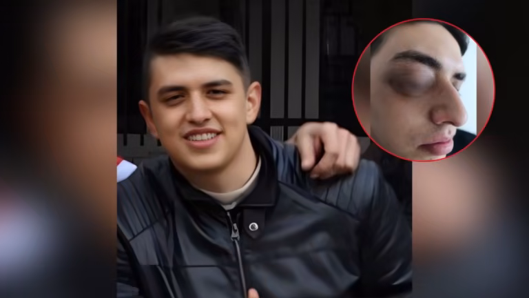 Ojo