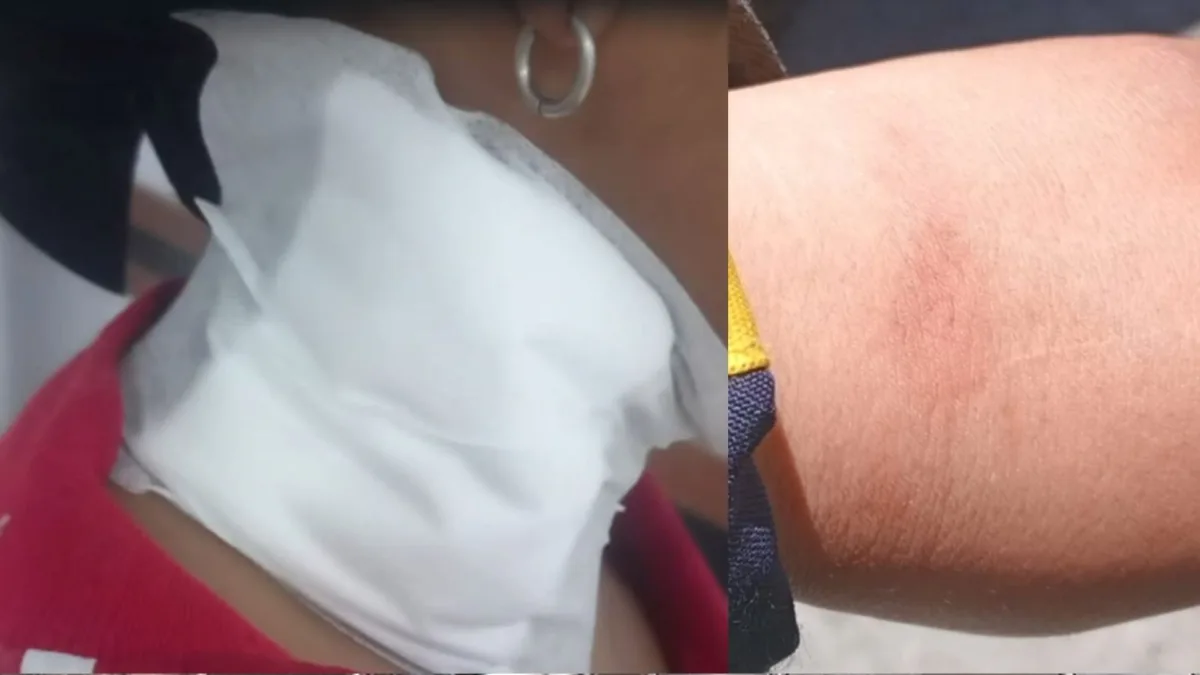 Soacha: pasajera roció sustancia química a guarda que le exigió el pago del pasaje Un acto de intolerancia en la estación San Mateo de Soacha terminó en un ataque con sustancia química contra una guarda de seguridad que, en cumplimiento de su trabajo, le pidió a una usuaria pagar el pasaje del sistema de transporte masivo.
